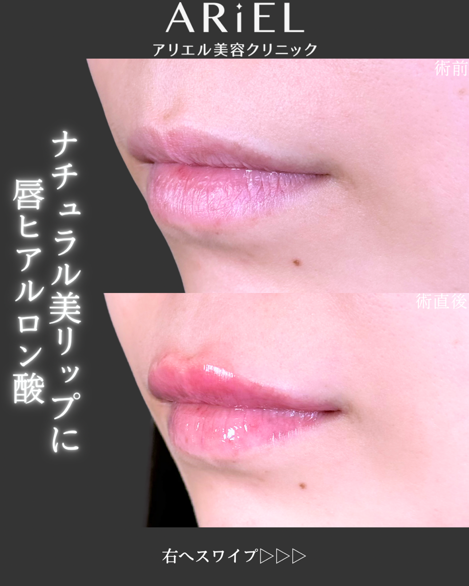 No.9226の症例写真